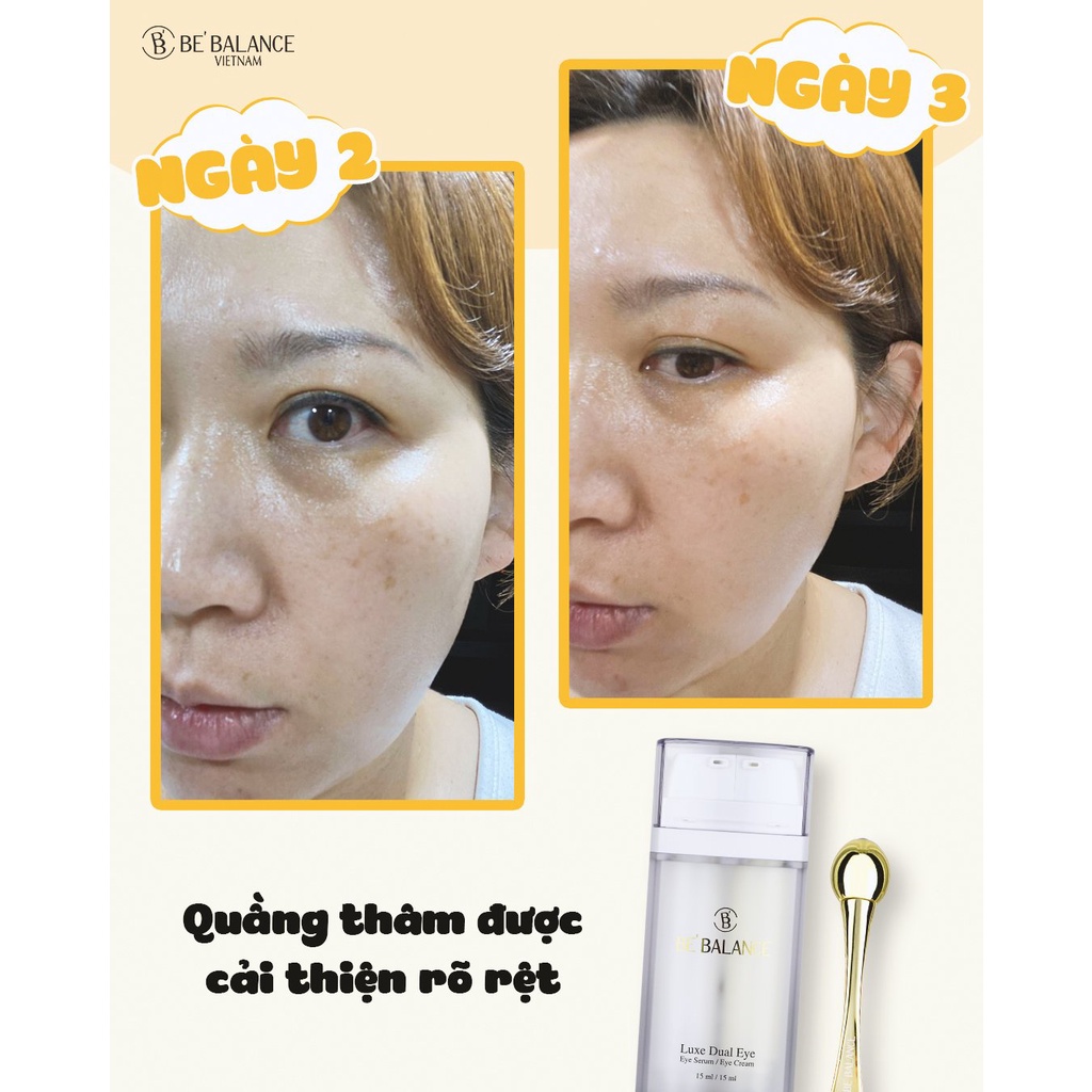 [HET HANG] Kem Mắt Be'Balance Luxe Dual Eye (30ml)