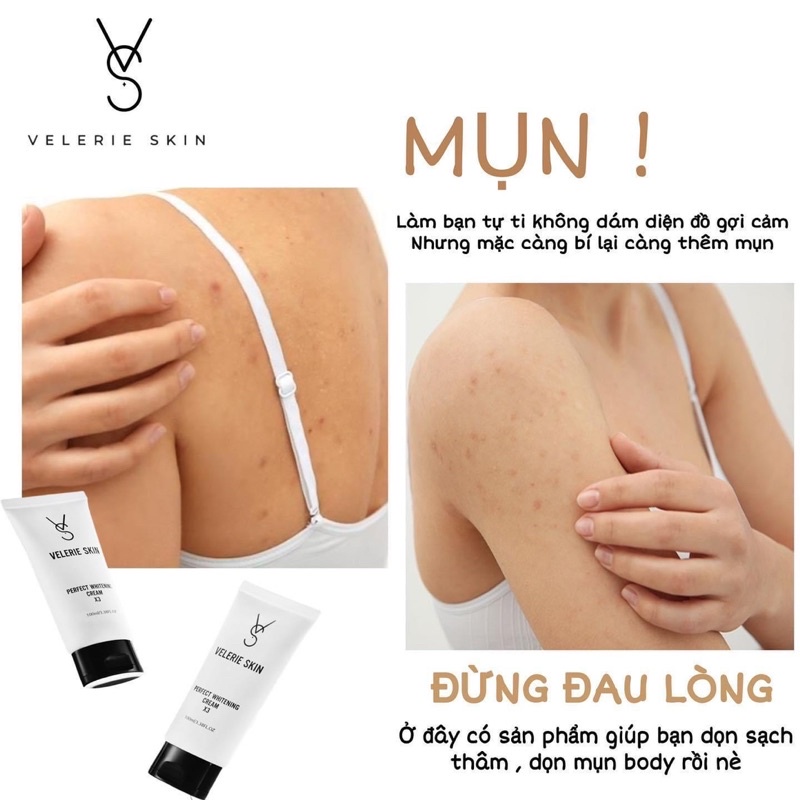 Kem VELERIE SKIN X3 Xoá Thâm - Xoá Mụn Body(Tặng kèm TBC Caffe dừa ) | BigBuy360 - bigbuy360.vn