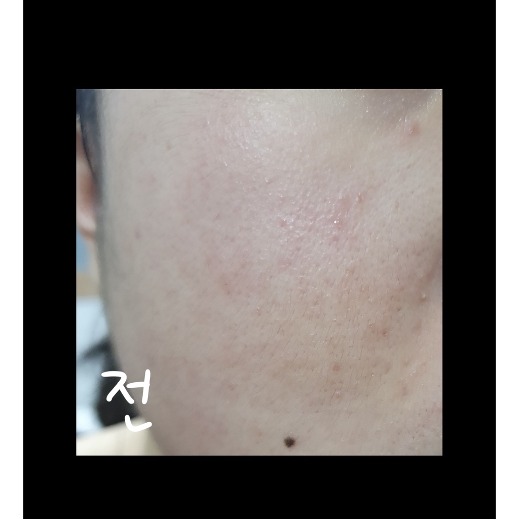 PRIMERA Toner dưỡng Ngải cứu phục hồi da mụn