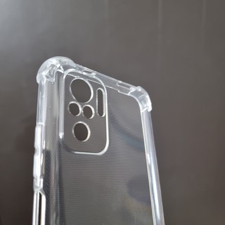Ốp lưng dẻo chống sốc Xiaomi Redmi Note 10S
