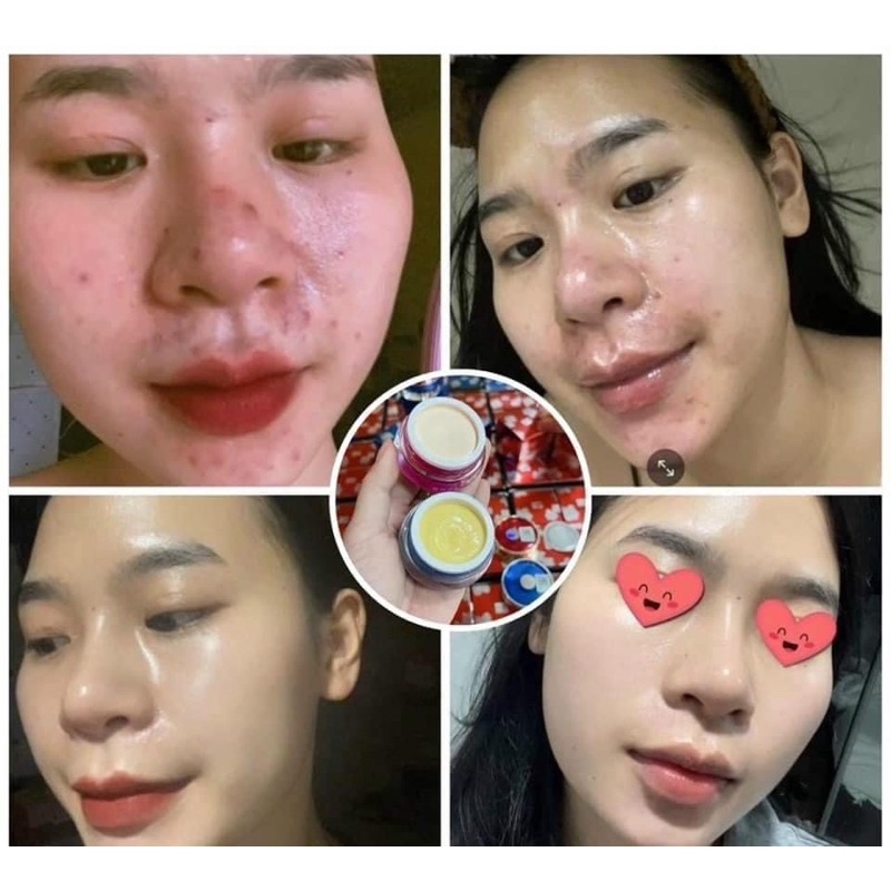 Combo 2 Kem Face Meiduzi Nhật và serum HD Phạm Điệp bộ dưỡng trắng ngày và đêm xoá mờ nám tàn nhang cực hiệu quả | BigBuy360 - bigbuy360.vn