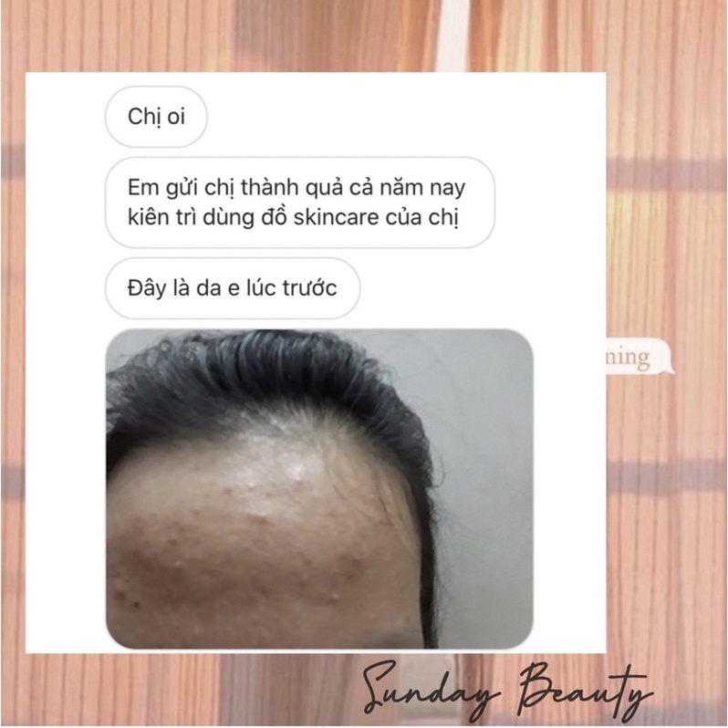Kem chấm mụn tràm trà giảm viêm se nhân mụn thiên nhiên Sunday Beauty handmade