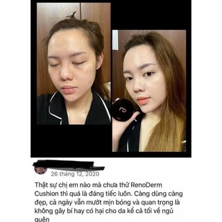 Phấn Nước Cushion Renoderm