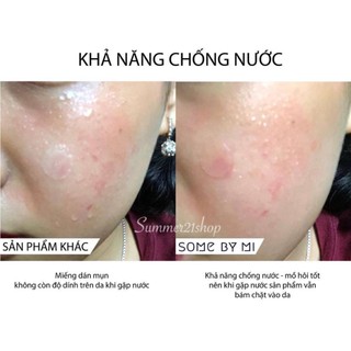 Miếng Dán Giảm Mụn Some By Mi Clear Spot Patch (Set 18 miếng)