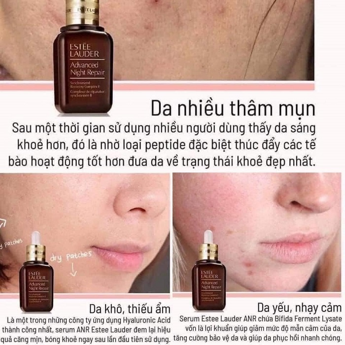 Serum  Estee Lauder Advanced Night Repair Phục Hồi Da , Dưỡng Ẩm , Chống Lão Hoá Da