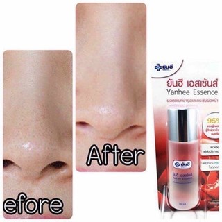 Nước thần nước hoa hồng yanhee thái lan