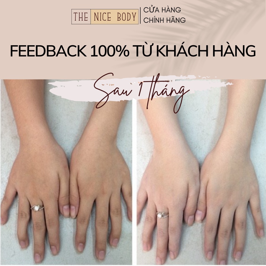 Kem Body Dưỡng Trắng Da Dạng Sữa Chứa 4% Alpha Arbutin Và 4% Kojic Acid Giúp Làm Trắng Toàn Thân The Nice Body | BigBuy360 - bigbuy360.vn