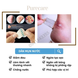 Miếng băng dán mụn nước, chống trầy gót, phỏng pô, xe máy, mụn cóc, phồng rộp chân - Bộ 1 cái