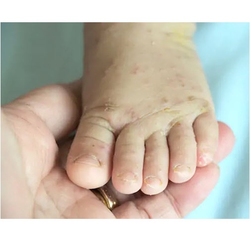 SẢN PHẨM CÓ SẴN