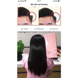 ÉP Side tóc nam 3in1 Hoa Anh Đào
