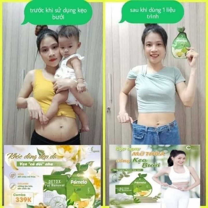 Kẹo Bưởi Chính Hãng Tặng Kèm Detox