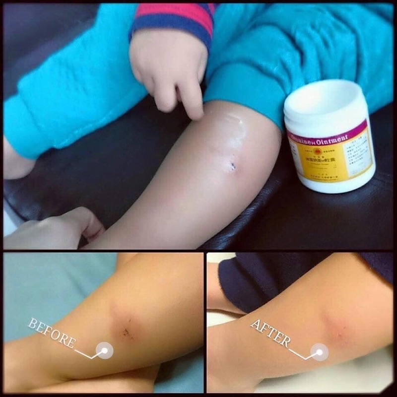 Kem Bôi Lành Vết Thương,vết Bầm Oronine Ointment Đa Năng 30gr Nhật Bản