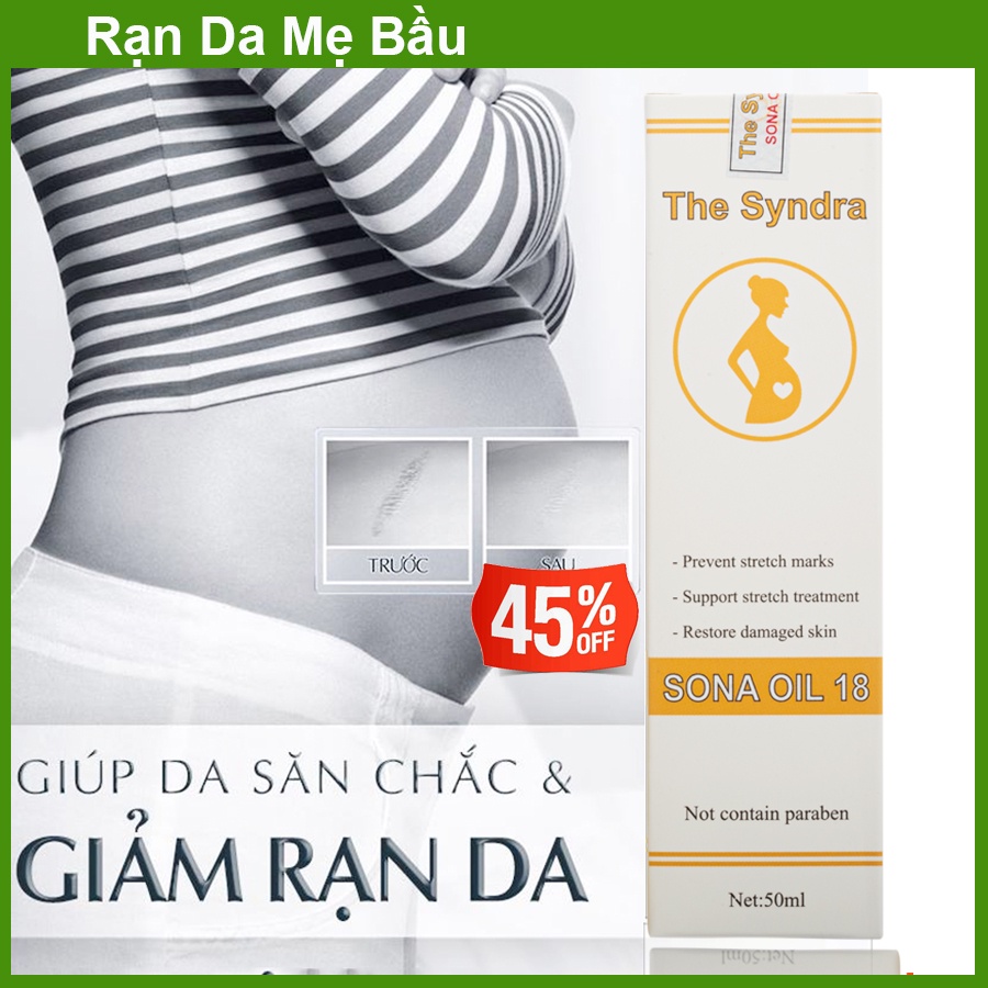 Dầu rạn da cho phụ nữ sau sinh- Sona oil 50ml,Tác dụng nhanh lành tính