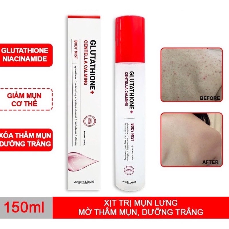 Xịt angel's liquid giảm mụn lưng làm trắng da