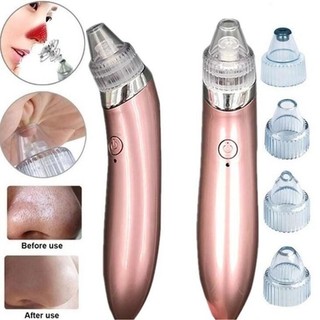 MÁY HÚT MỤN - MÁY HÚT MỤN - MÁY HÚT MỤN