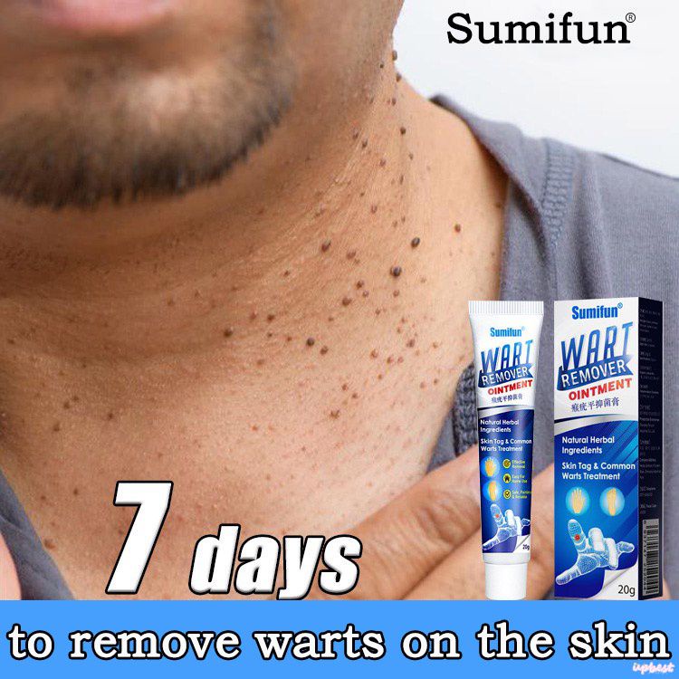 ♕Sumifun Gel Loại Bỏ Mụn Cóc Thuốc Mỡ Gel Loại Bỏ Thẻ Da Chăm Sóc Cơ Thể Mặt Tẩy Nốt Ruồi Loại Bỏ Mụn Cóc Cơ Thể Điều Trị Y Tế Tự Nhiên Hữu Cơ Thảo Dược 20G Upbest
