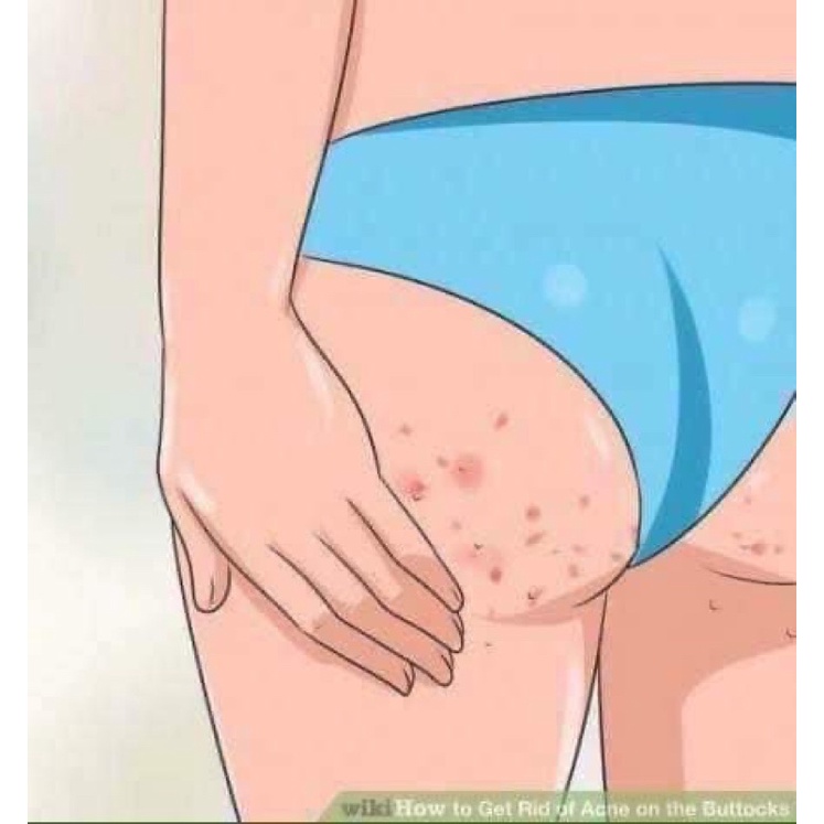 01 Kem Dưỡng Trắng Giảm Thâm Vùng Mông ISME WHITENING 50gr Thái Lan