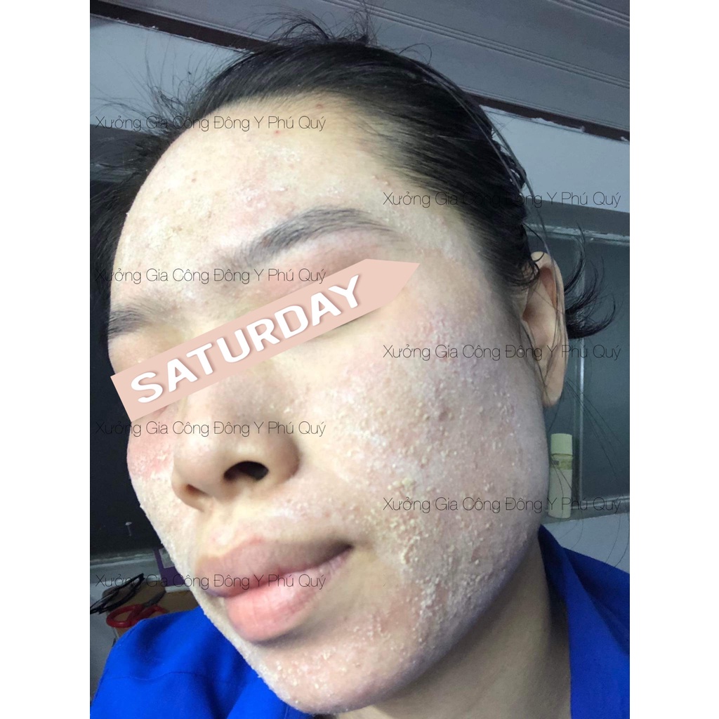 Kem Tái Tạo My My Vip Chuẩn Spa Tặng Kích Bong