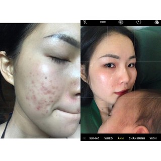 Tái tạo da sâm linh dược ( không bột - mạnh)
