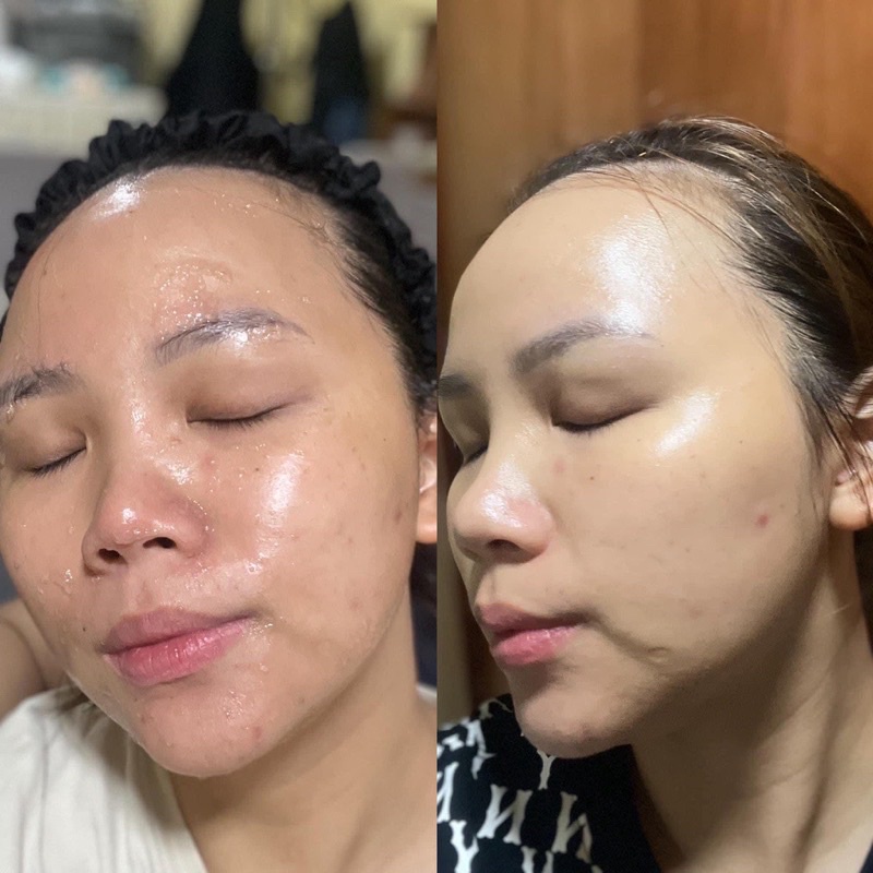 Lẻ 1 gói REJUVENATING PEPTIDE GEL MASK - Mặt Nạ Peptide Phục Hồi Trẻ Hoá Da