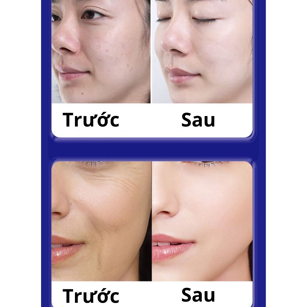Kem UCM xóa nám, tàn nhang, trẻ hóa  làn da Nội địa Nhật chính hãng