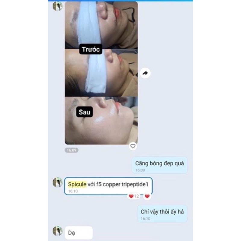 SPICULE - TRẮNG DA TOÀN DIỆN
