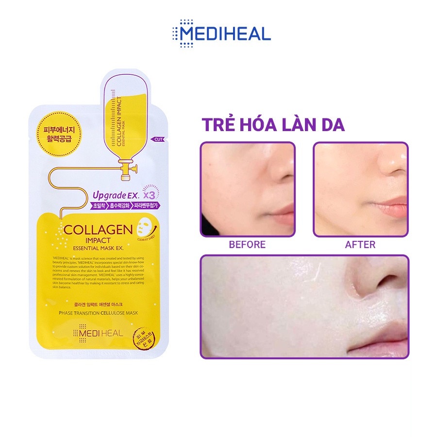Mặt Nạ Mediheal Collagen Impact Essential Mask EX Ngăn Ngừa Lão Hóa Da 25ml