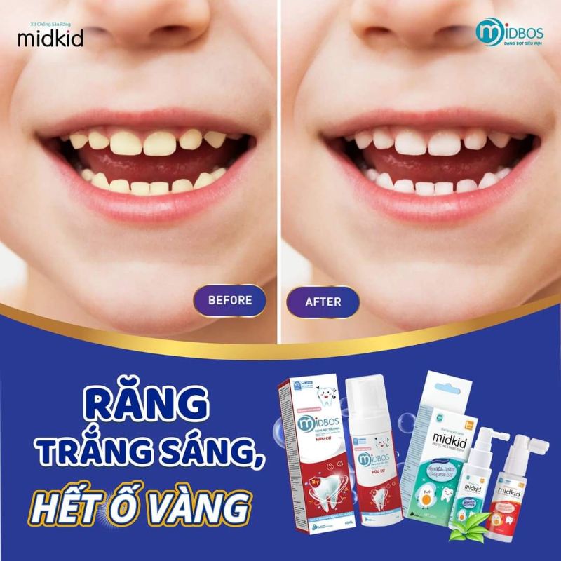 Xịt Chống Sâu Răng MIDKID Cho Bé Từ 1 Tuổi, An Toàn Nuốt Được