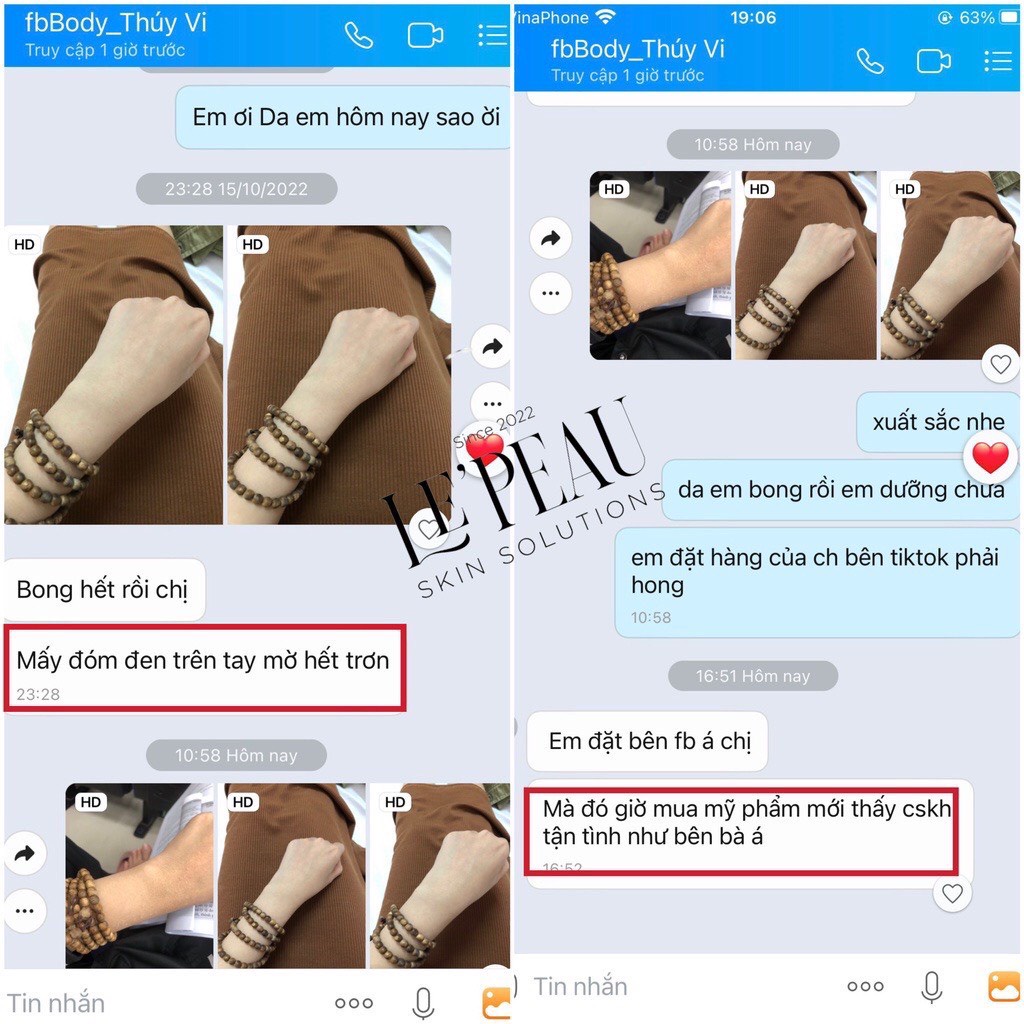 Peel nách retinol, peel đầu gối, peel body khử thâm và làm trắng da Lepeau chính hãng 100%