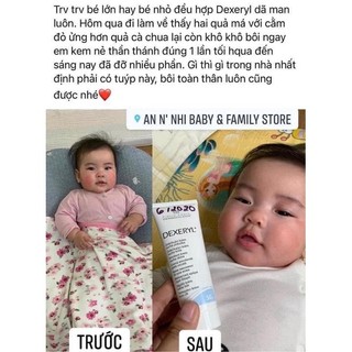 Kem dưỡng da DEXERYL