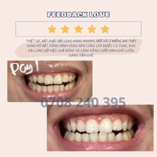 Miếng Dán Trắng Răng Crest 3D White Combo 7 gói (Đầy đủ bill Store)