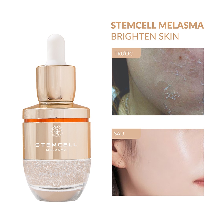 Tinh chất peel da Stemcell Melasma Brighten Skin