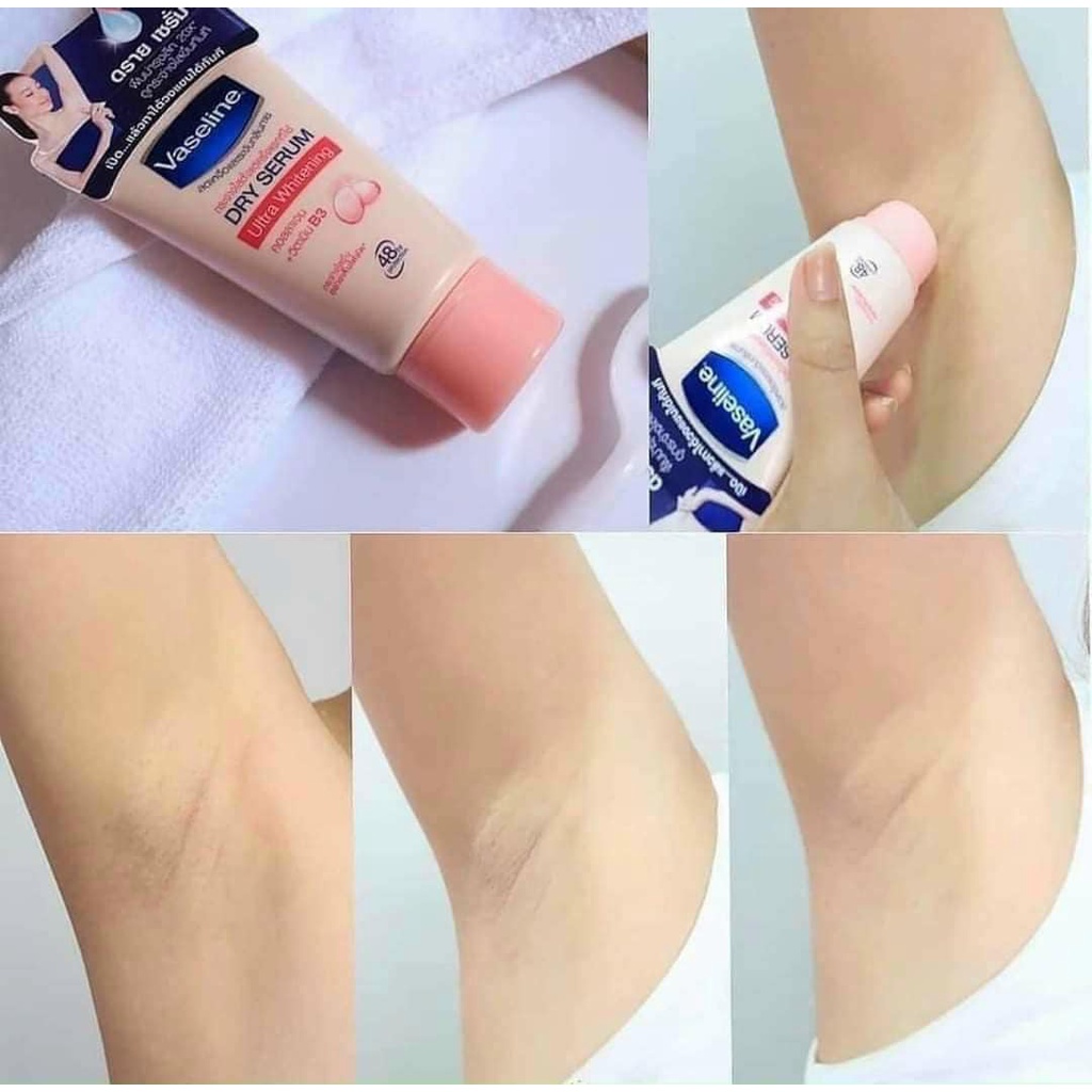 Kem dưỡng da khử mùi vùng nách Vaseline 45ml