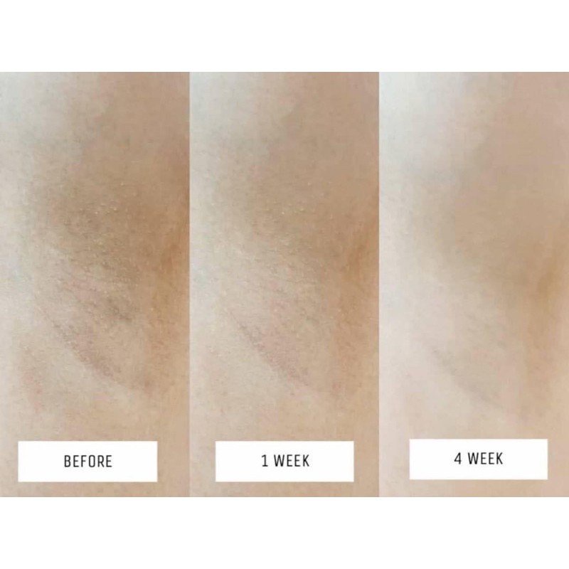 Kem dưỡng da khử mùi vùng nách Vaseline 45ml