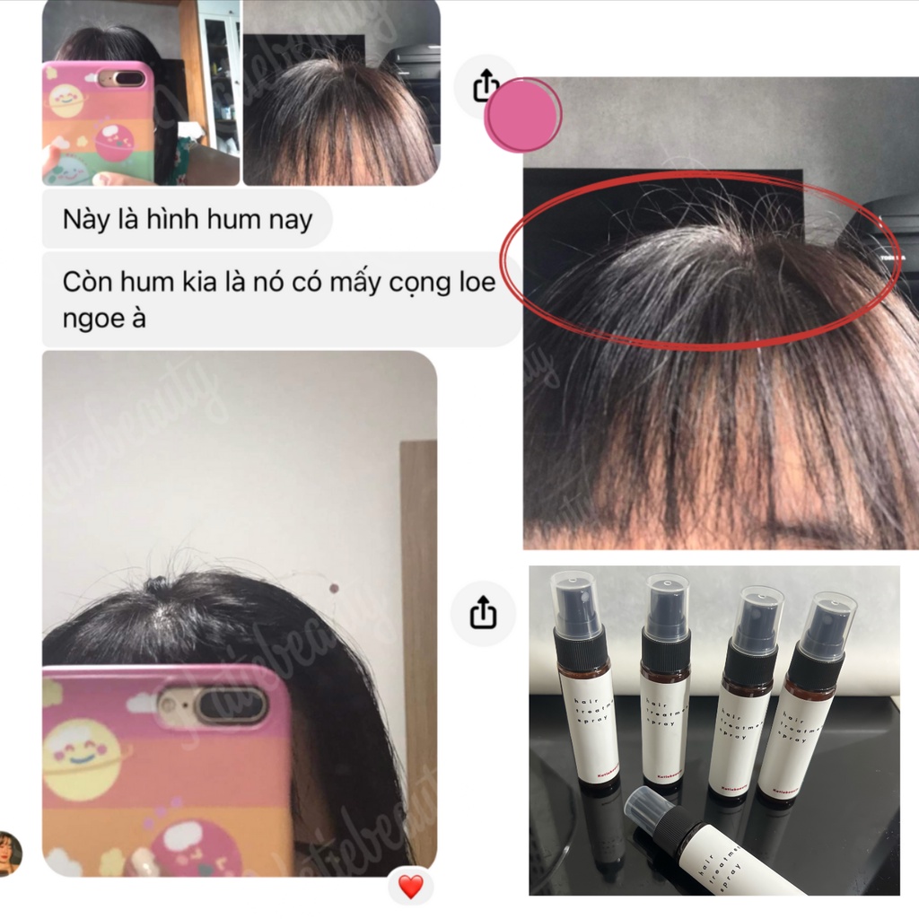 Xịt kích mọc tóc men vi sinh HAIR TREATMENT SPRAY 30ml | KATIEBEAUTY