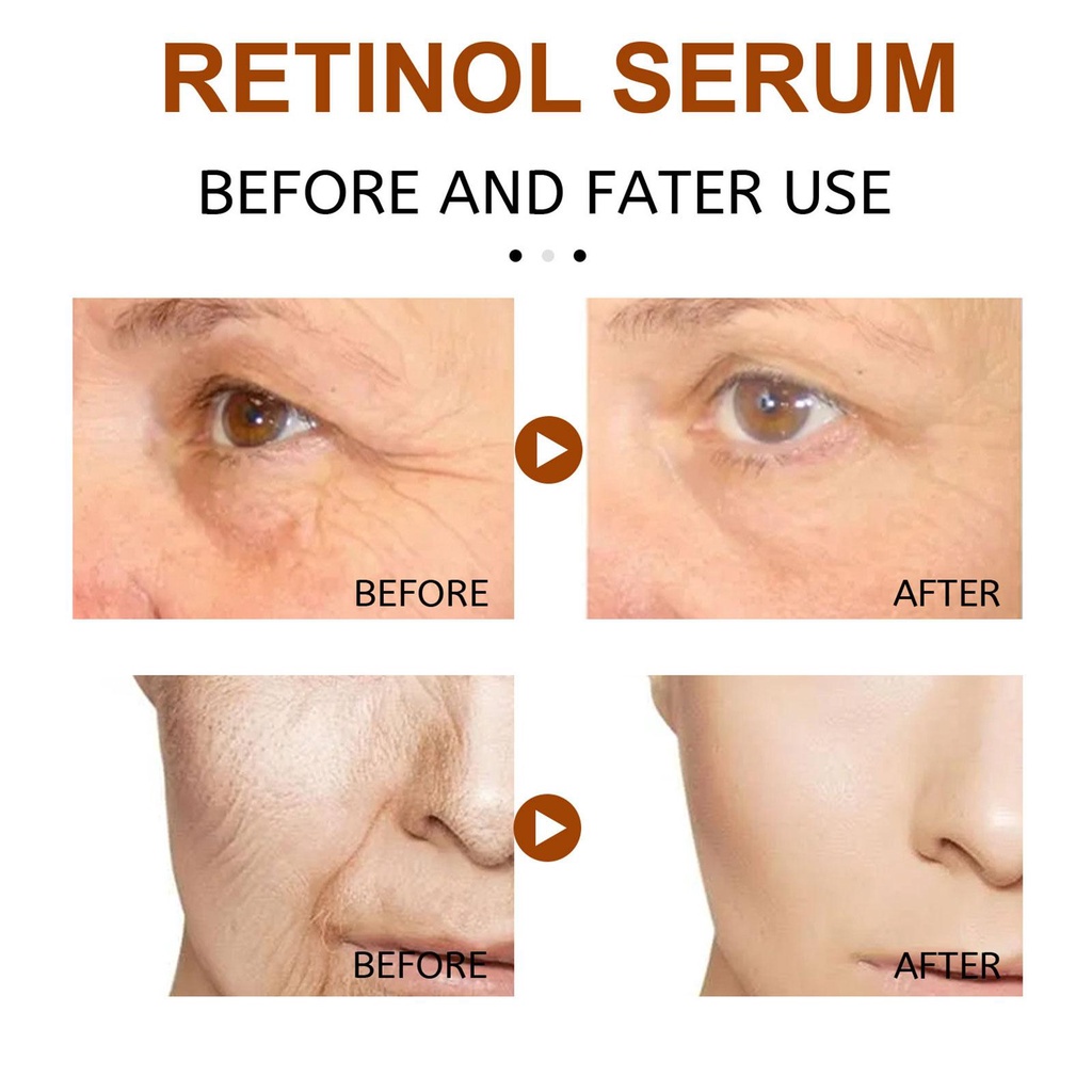 Serum Retinol 30ml Chống Lão Hóa Làm Săn Chắc Da W4K4