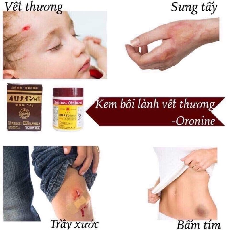 Kem Bôi Lành Vết Thương,vết Bầm Oronine Ointment Đa Năng 30gr Nhật Bản