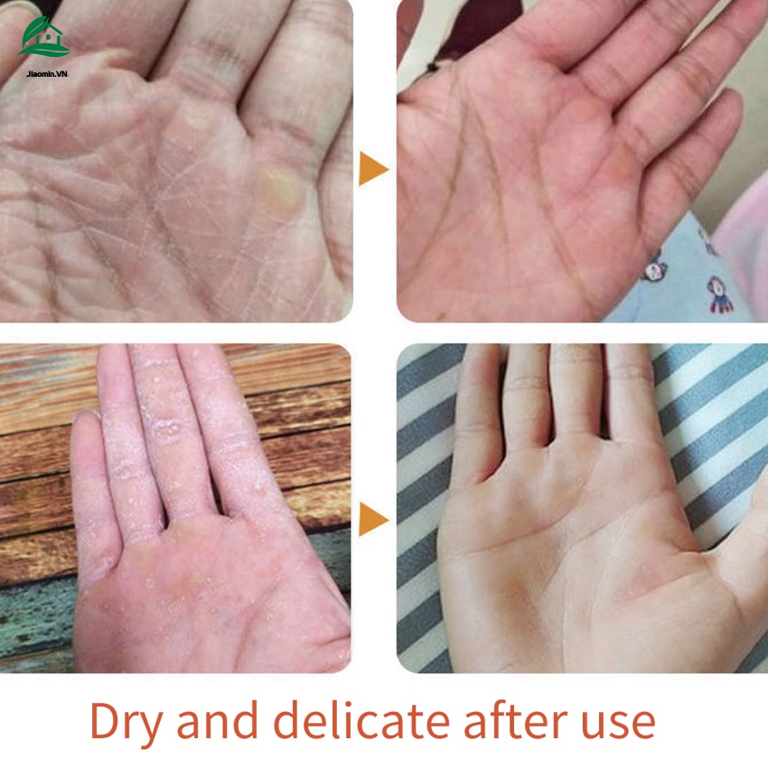 Kem dưỡng ẩm chống lão hóa làm trắng da tay