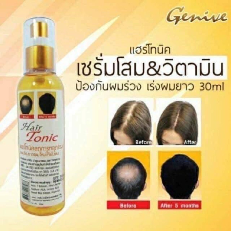 Chai Xịt Mọc Tóc Genive Hair Tonic 120ml Thái Lan, Hàng Chính Hãng