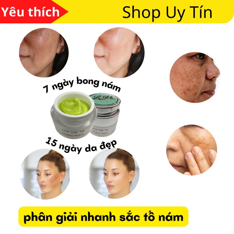 Bong nám,phân giải sắc tố tái tạo da nám