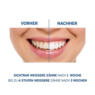 🇩🇪🇩🇪KEM ĐÁNH RĂNG SIÊU TRẮNG PERL WEISS🇩🇪🇩🇪