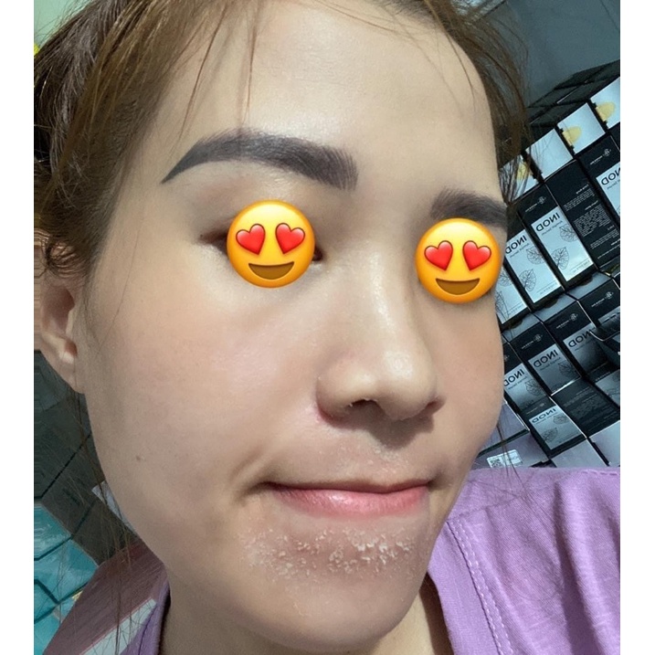 Combo peel da nhân sâm và b5 phục hồi huyền phi