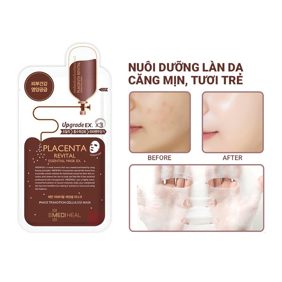 Mặt Nạ Nhau Thai Cừu Mediheal Placenta Revital Essential Mask EX Phục Hồi Da 25ml