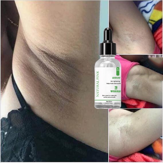 Serum  Thâm Nách Bẹn Chân Tay Đầu Gối Dưỡng Ẩm Làm Sáng Da 30ml