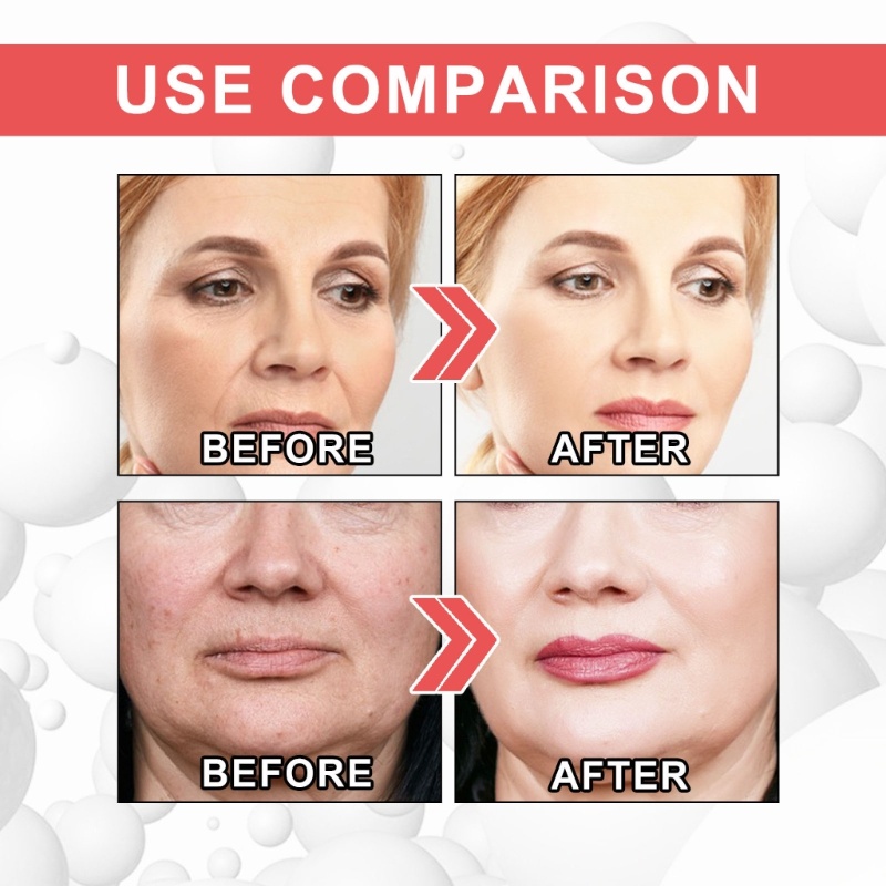 Kem Collagen Dưỡng Ẩm Làm Săn Chắc Da Mặt / Tay / Toàn Thân YOUYO
