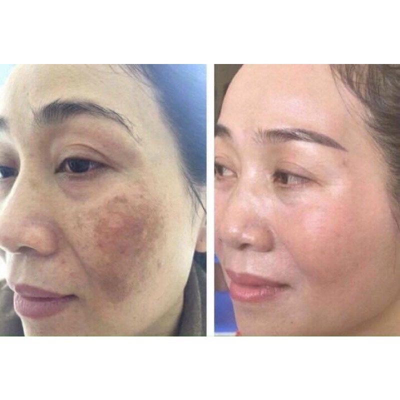 Kem tái tạo sâm tươi cao cấp,20gr căng bóng trắng mịn se khít lỗ chân lông handmade