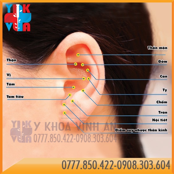 Nhĩ Châm Dán Hạt Vương Bất Lưu Hành Hộp 600 Hạt Từ Tính Gói 100 Hạt