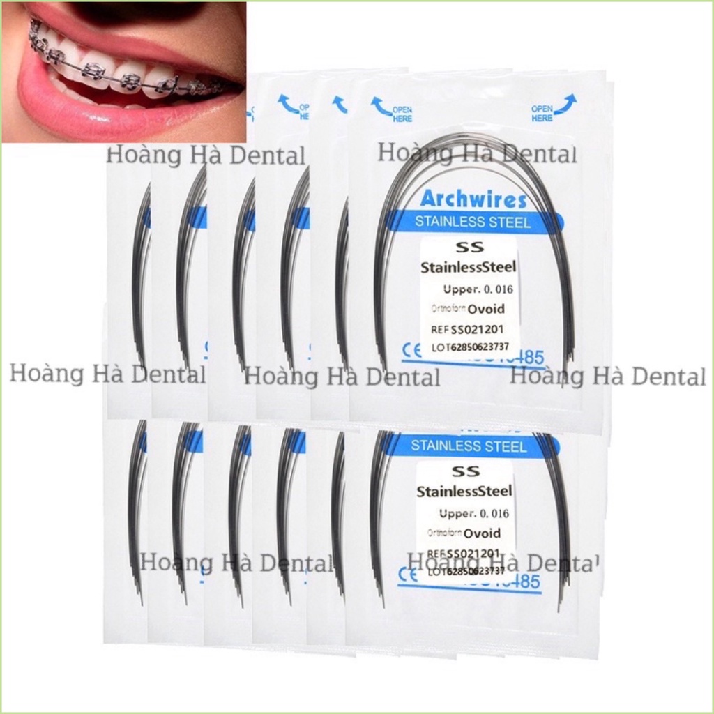 Dây ss chỉnh nha Dây cung ss niềng răng - NHA KHOA HÀ NỘI