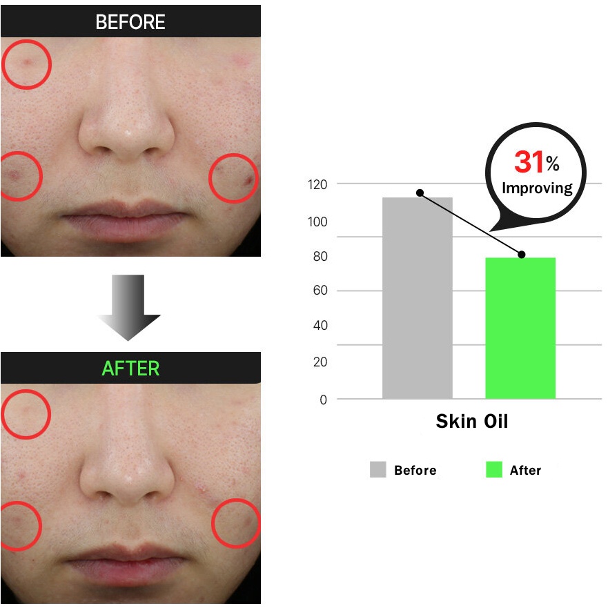 Bộ Serum Đặc Biệt Nosca 9 Trouble