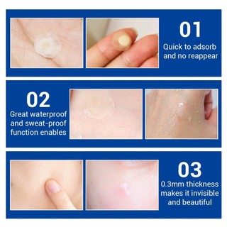 Miếng dán mụn Lanbena Breylee Acne Pimple Patch
